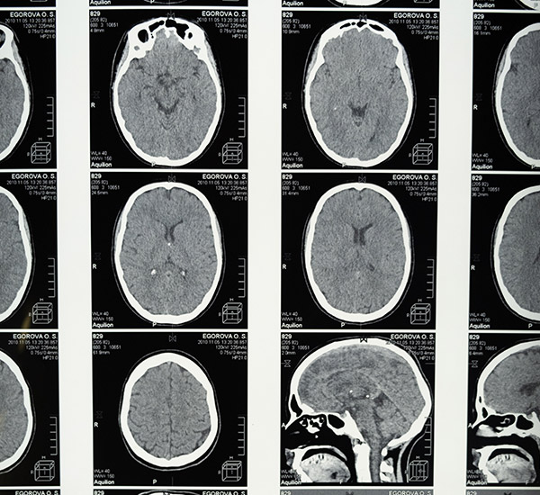 Images of concussions on paper